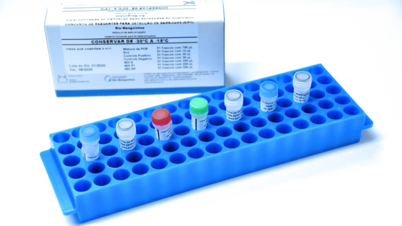 Fiocruz - Laboratório fará extração de amostras utilizando os “kits biomanguinhos” fornecidos pelo Ministério da Saúde