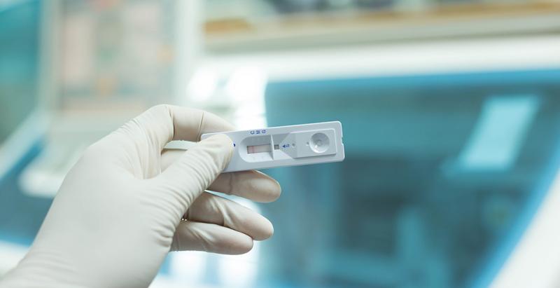 Shutterstock - Testes devem ser aplicados em pessoas cujos sintomas compatíveis com síndrome gripal tenham se iniciado há pelo menos 8 dias