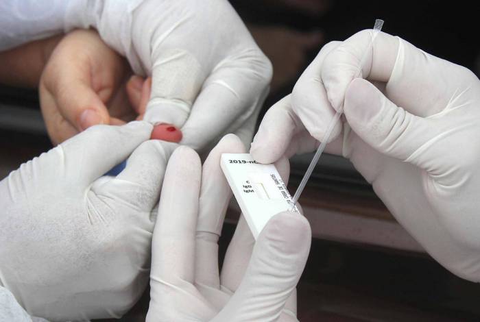  Agência Brasil - Teste sanguíneo rápido utiliza metodologia por punção digital