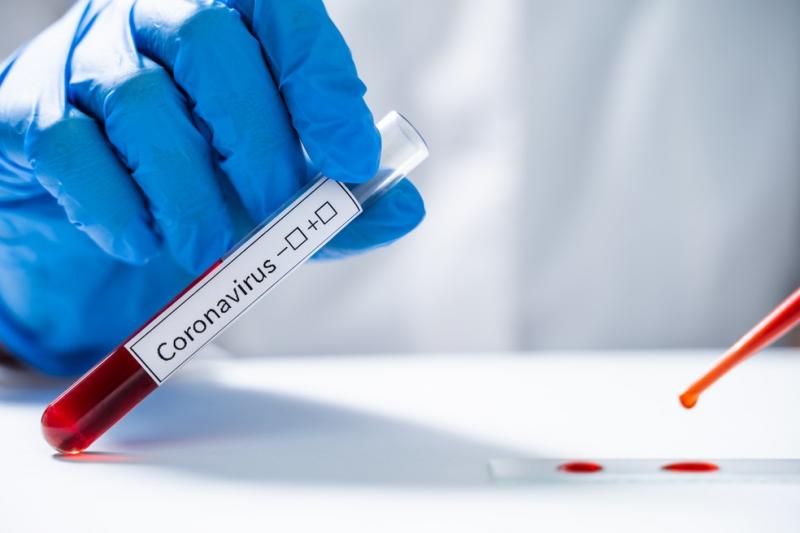 Região registrou mais 495 casos positivos do novo coronavírus