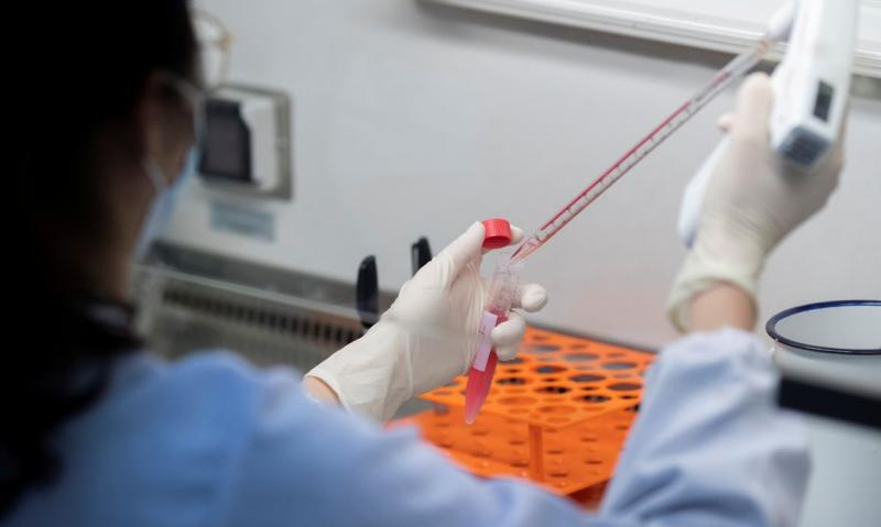 Região confirmou mais 637 casos da doença 