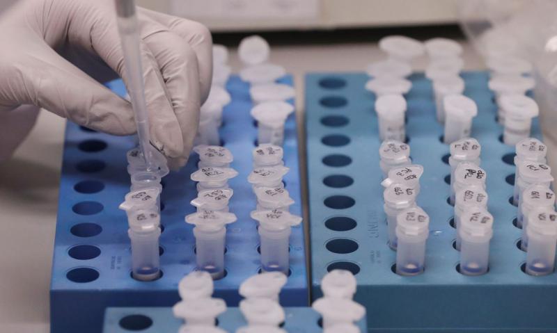 Região confirmou mais 281 casos da doença 