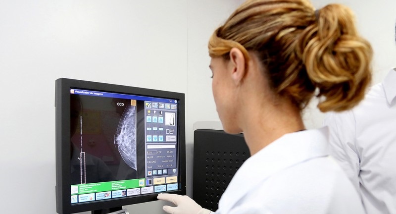 Entidade pleiteará recursos para aquisição de equipamentos como mamógrafo