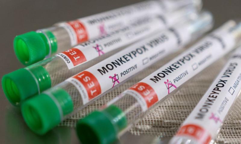 Instituto Adolfo Lutz confirmou primeiro caso da monkeypox em Prudente na tarde desta quarta-feira