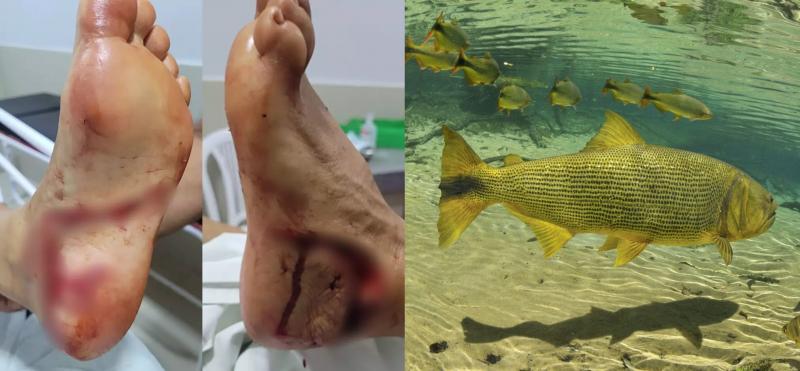 À esquerda, pé ferido de turista prudentina após ataque de dourado; à direita, imagem do Salminus brasiliensis