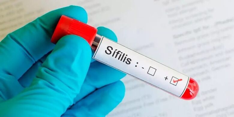 Testes de triagem para sífilis, hepatite B, hepatite C e HIV estão disponíveis gratuitamente nos postos de saúde do Sistema Único de Saúde