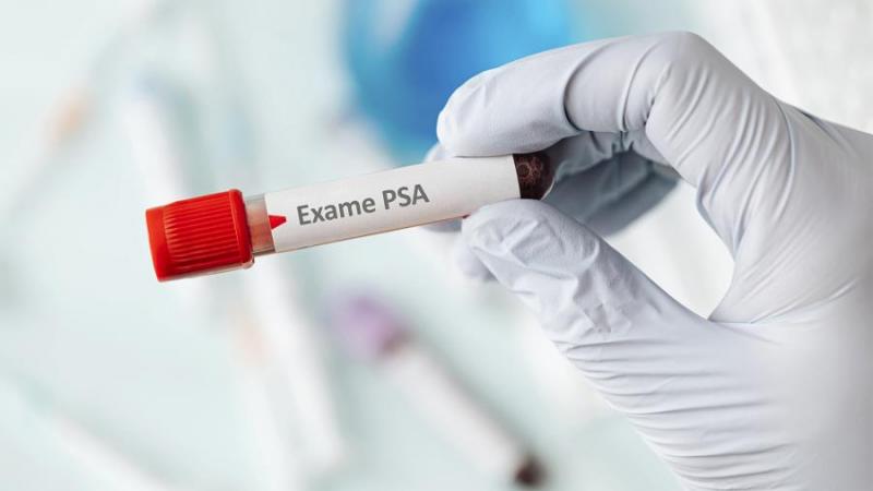 A partir das 8h, será realizada a coleta de exames de PSA