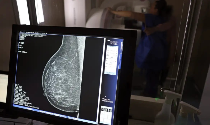 Ação contempla desde oferta de mamografia até inserção da mulher do campo no SUS
